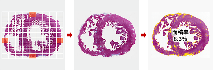 組織切片全体の定量解析