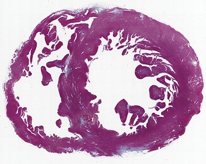 ハイブリッドセルカウント