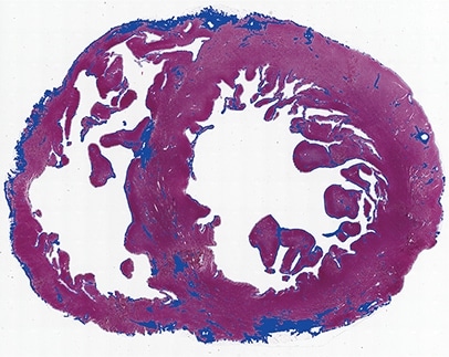 ハイブリッドセルカウント