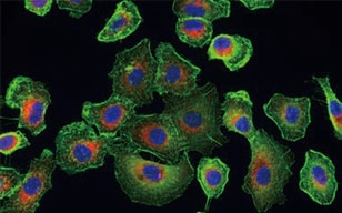 I型肺胞上皮がん細胞の多重染色観察