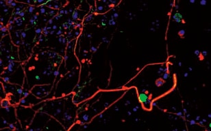 ES細胞の神経系細胞への分化