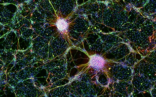 ヒトiPS細胞由来神経細胞