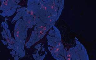 ランゲルハンス島におけるα細胞とβ細胞の可視化