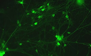 iPS細胞由来神経細胞の活動