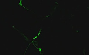 神経前駆細胞（PC12）軸索伸長
