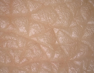 肌のキメ（皮膚のレプリカ）のマルチライティング画像